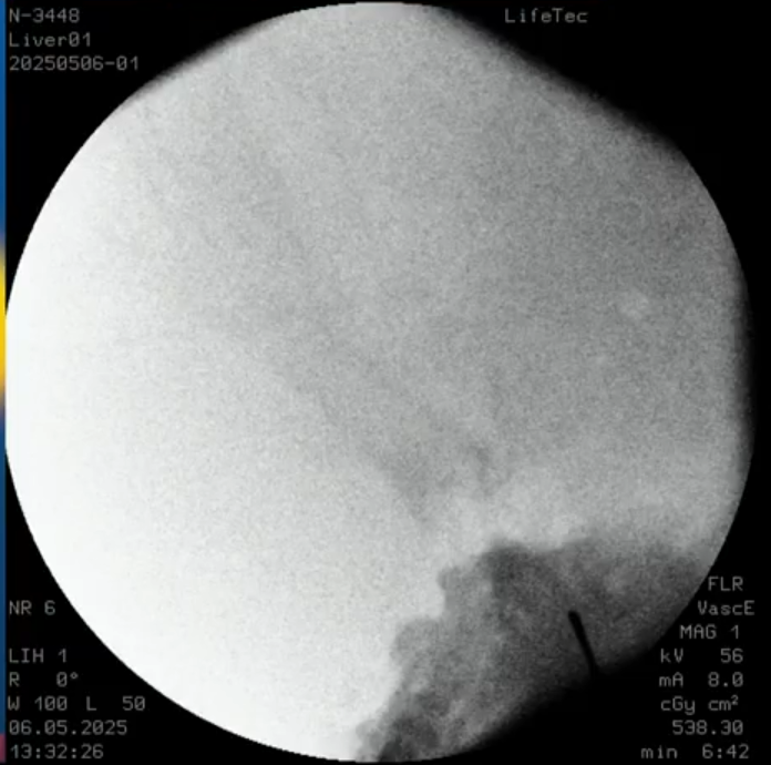 NovaSeal Development